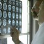 doctor looking at brain scans health hazards