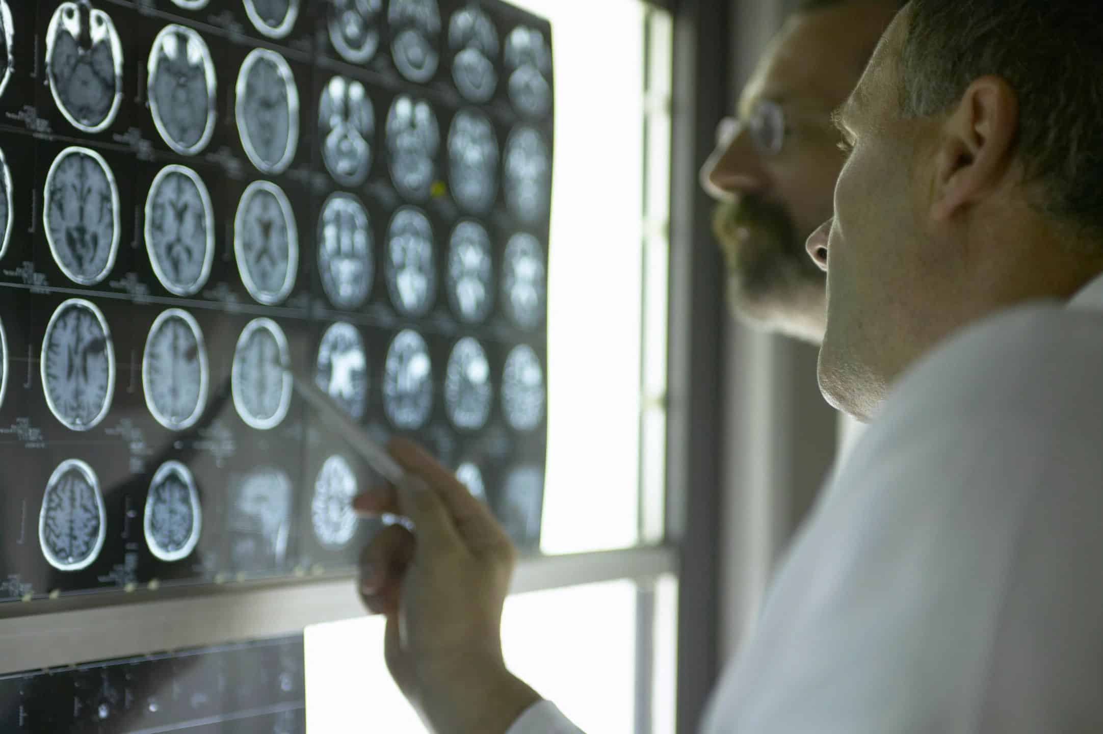 doctor looking at brain scans health hazards